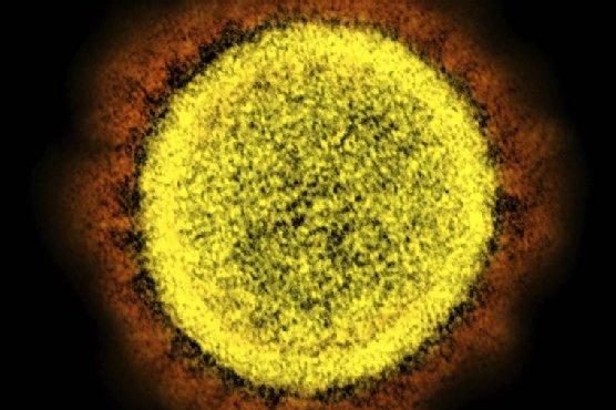 Doctors studying why obesity may be tied to serious COVID-19